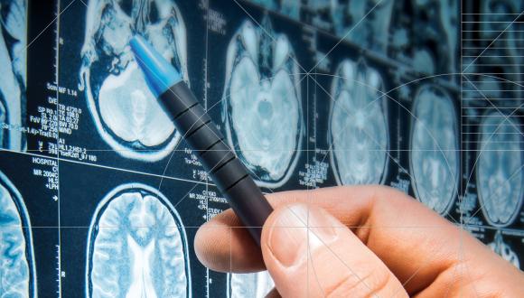 לפענת מאות תמונות MRI בכלים אוטומטים המבוססים על שיטות ראיה ממוחשבת